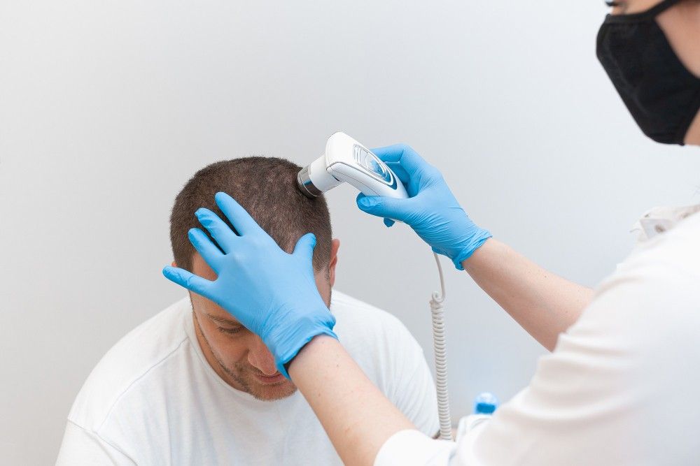Photo illustrating the preparatory consultation for a hair transplant in Albania.